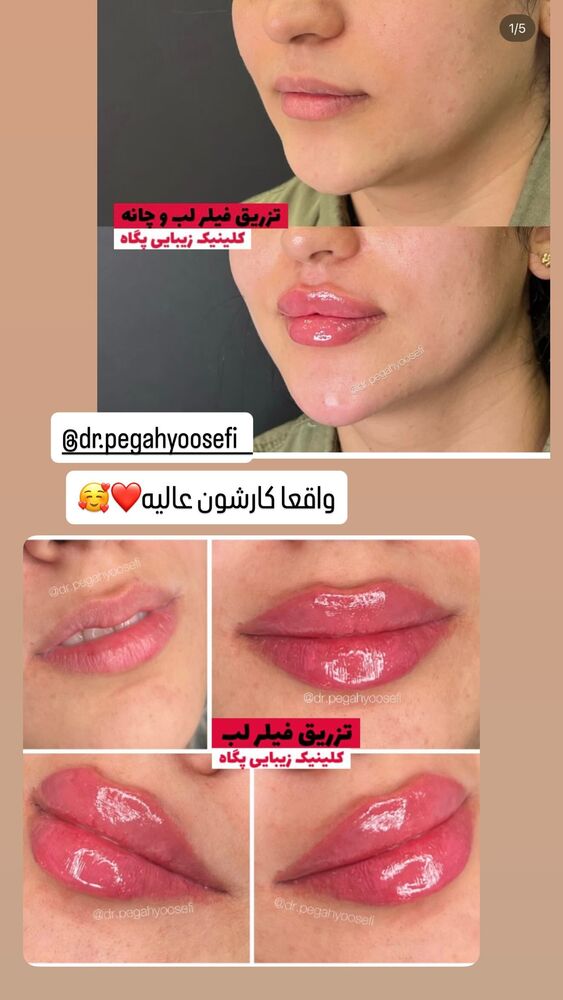  جدید ترین استوری اینستاگرام گیتا اخوان