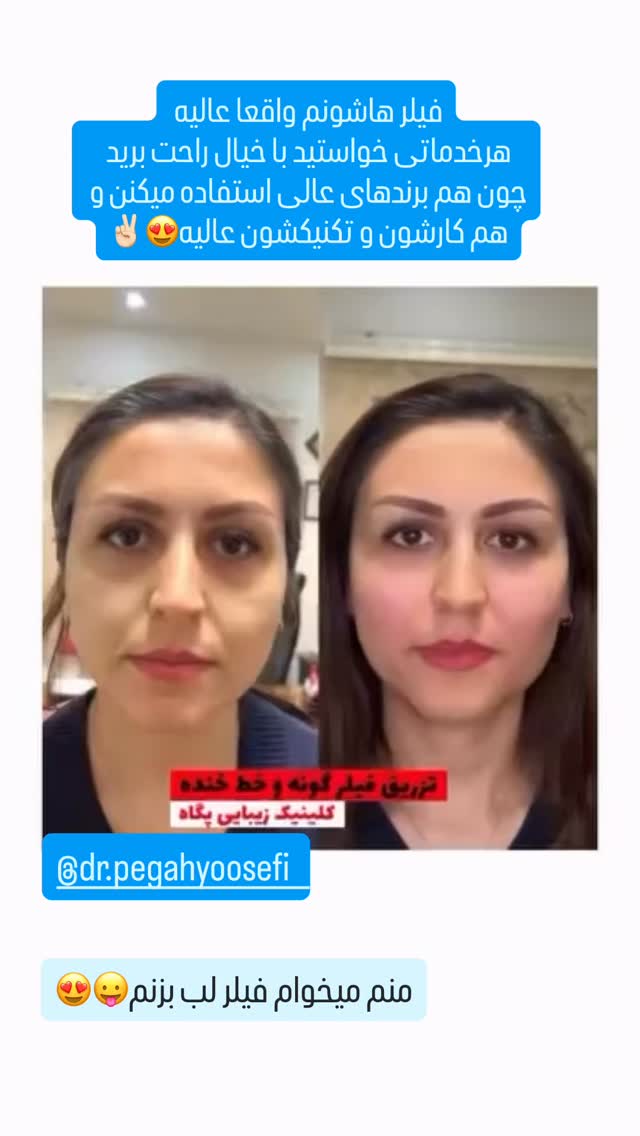  جدید ترین استوری اینستاگرام گیتا اخوان