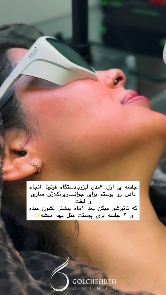  جدید ترین استوری اینستاگرام حدیثه حیدری