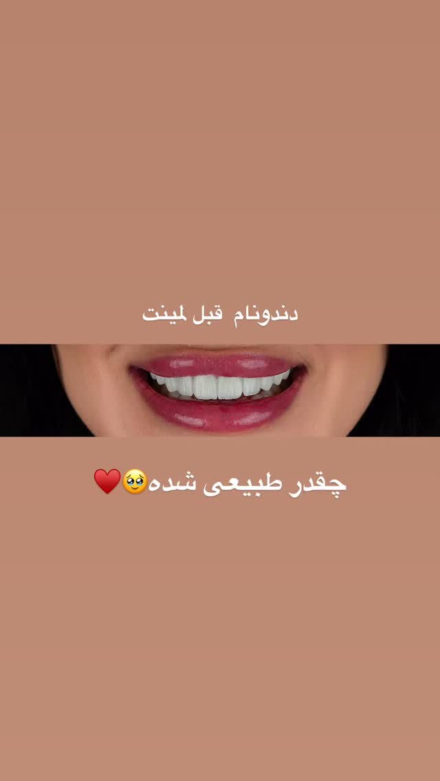  جدید ترین استوری اینستاگرام حدیثه حیدری