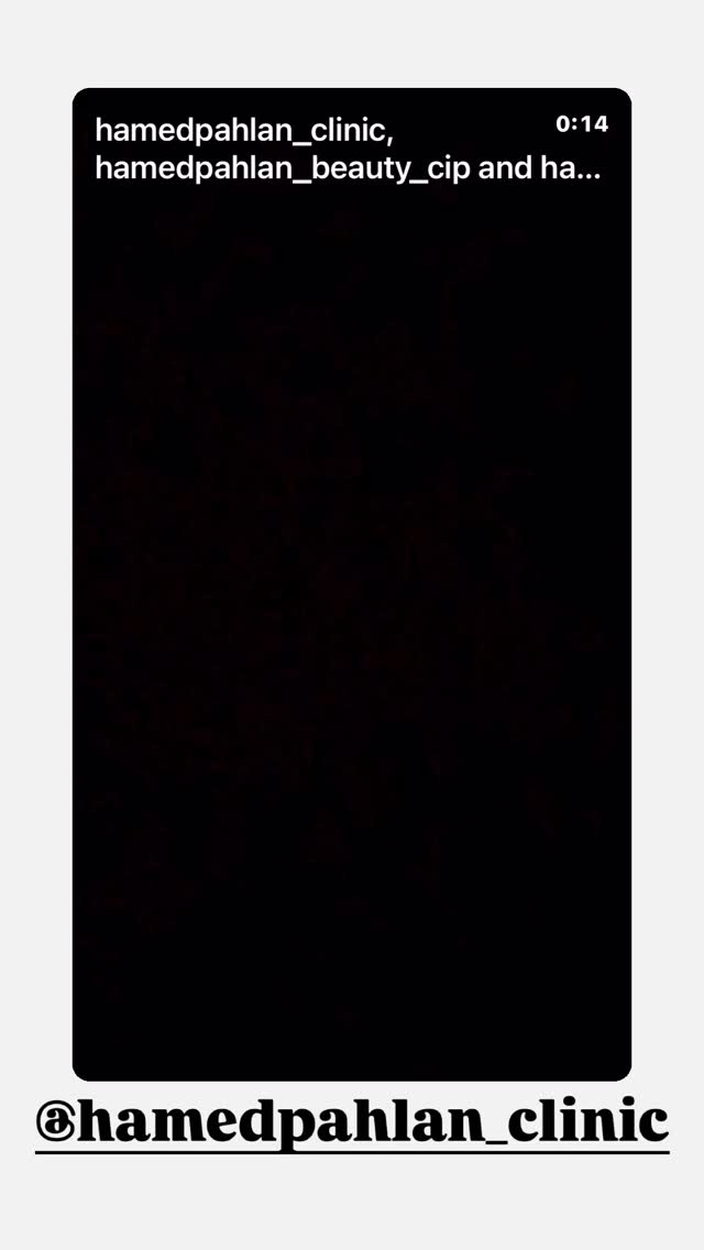  جدید ترین استوری اینستاگرام حامد پهلان