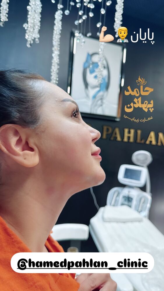  جدید ترین استوری اینستاگرام حامد پهلان