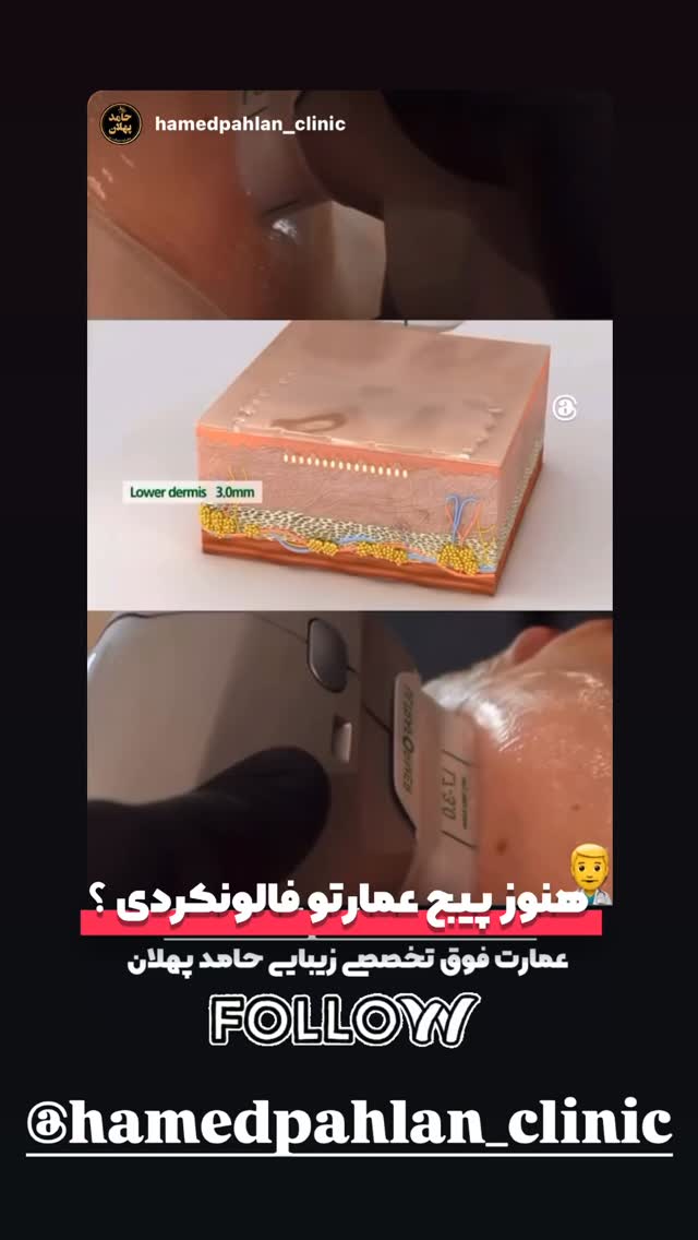  جدید ترین استوری اینستاگرام حامد پهلان