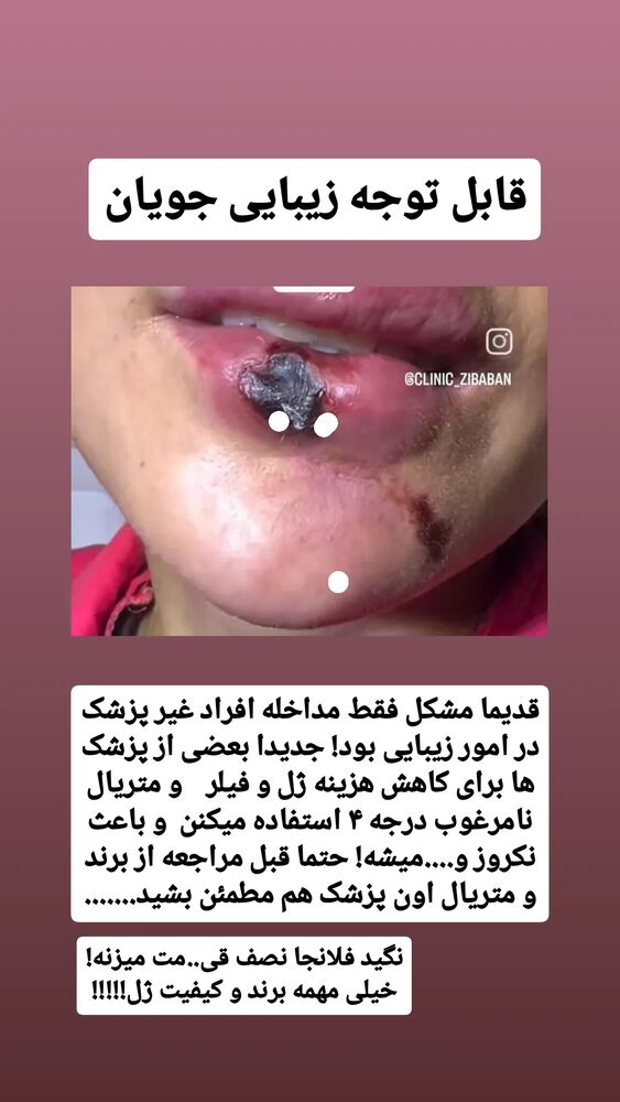 جدید ترین استوری اینستاگرام حامد رئیسی