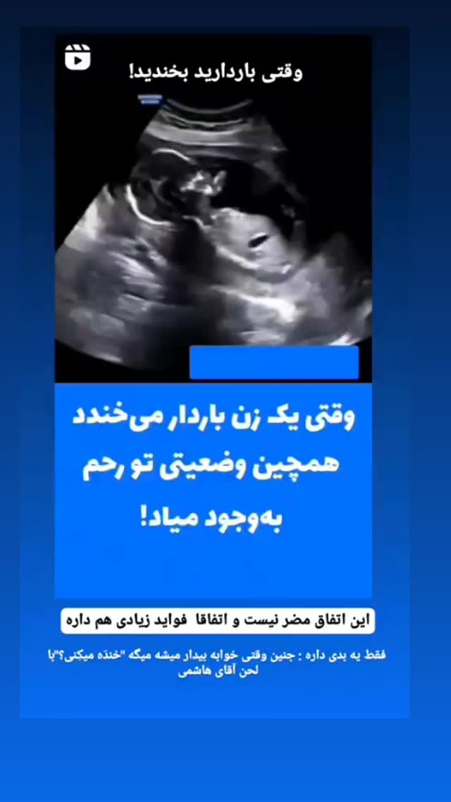  جدید ترین استوری اینستاگرام حامد رئیسی