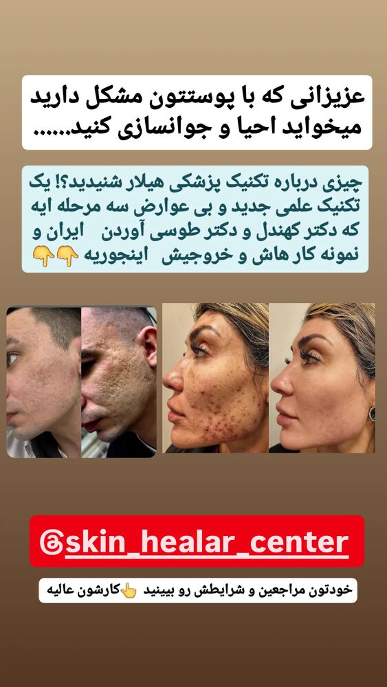  جدید ترین استوری اینستاگرام حامد رئیسی