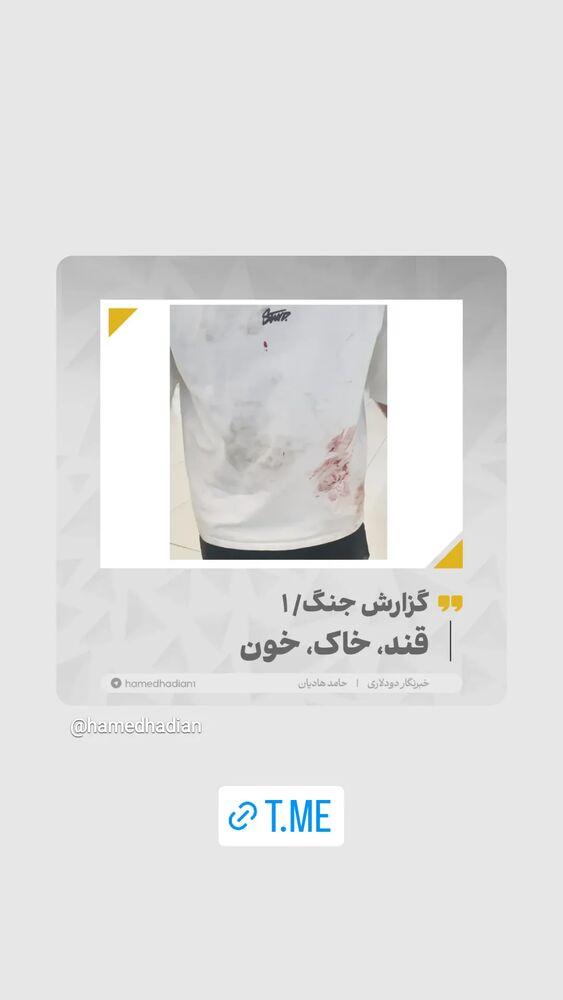  جدید ترین استوری اینستاگرام حامد هاديان