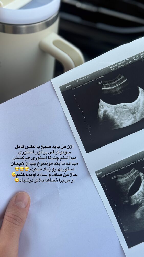  جدید ترین استوری اینستاگرام حمیده دانشور