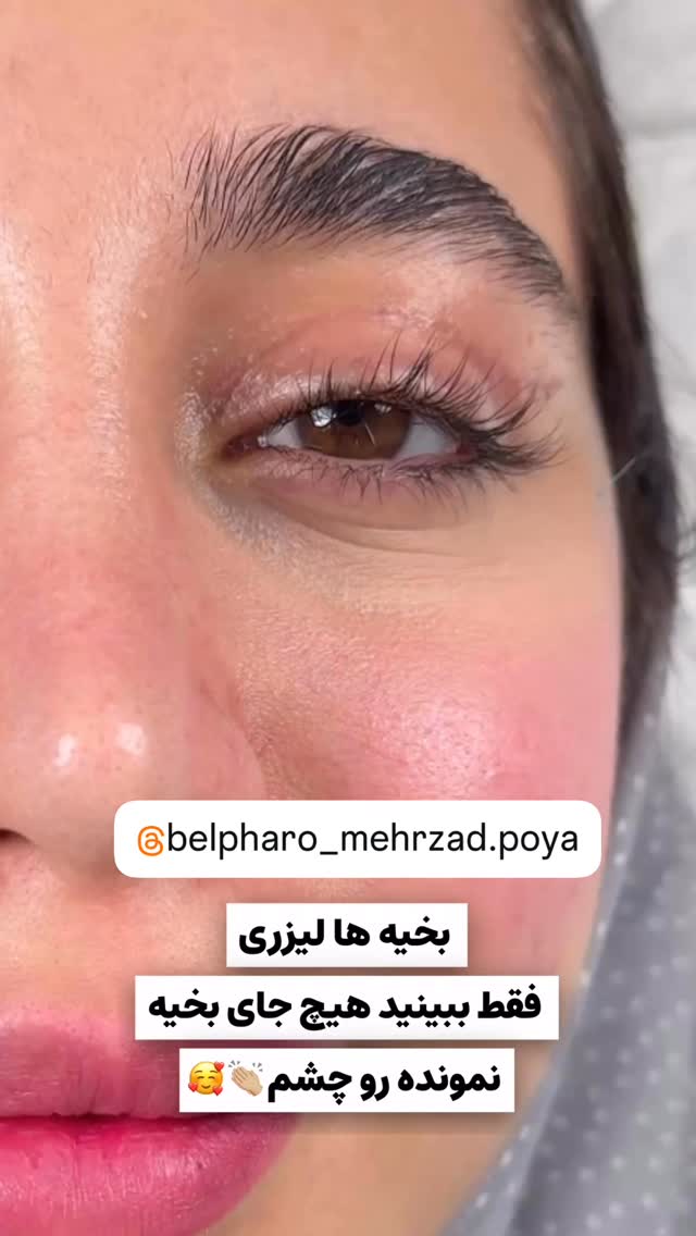  جدید ترین استوری اینستاگرام هانی