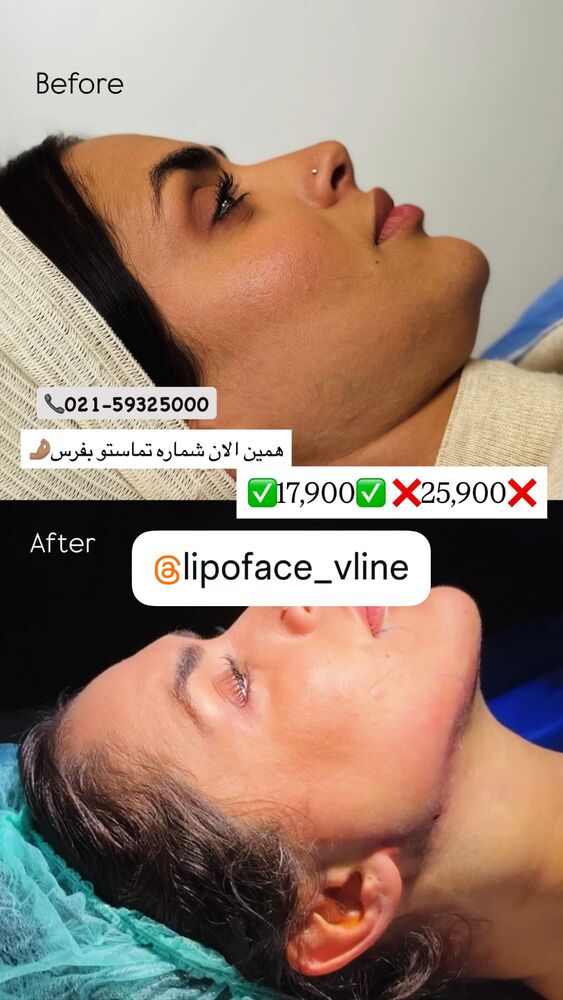  جدید ترین استوری اینستاگرام هانی