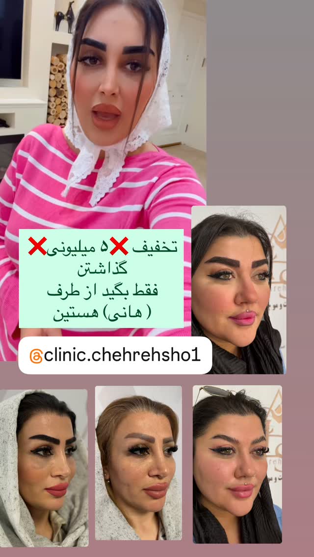 جدید ترین استوری اینستاگرام هانی