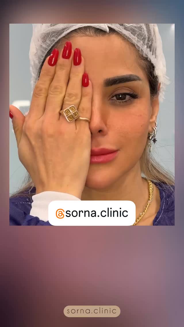  جدید ترین استوری اینستاگرام هانی