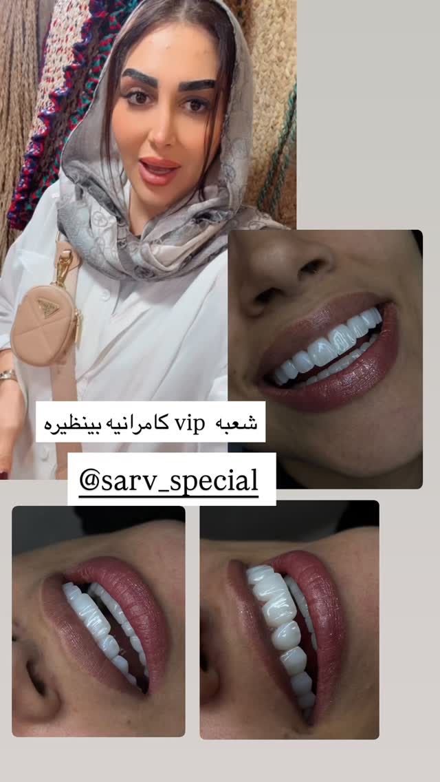  جدید ترین استوری اینستاگرام هانی