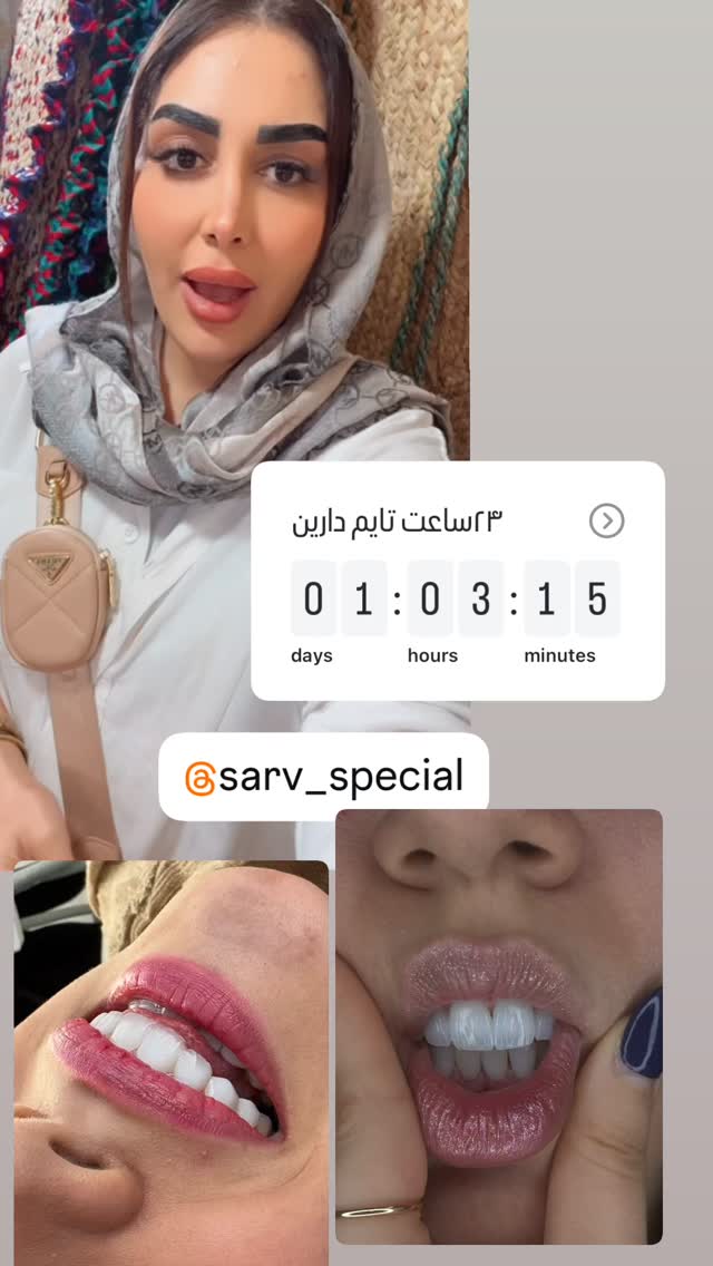  جدید ترین استوری اینستاگرام هانی