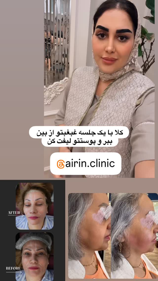  جدید ترین استوری اینستاگرام هانی