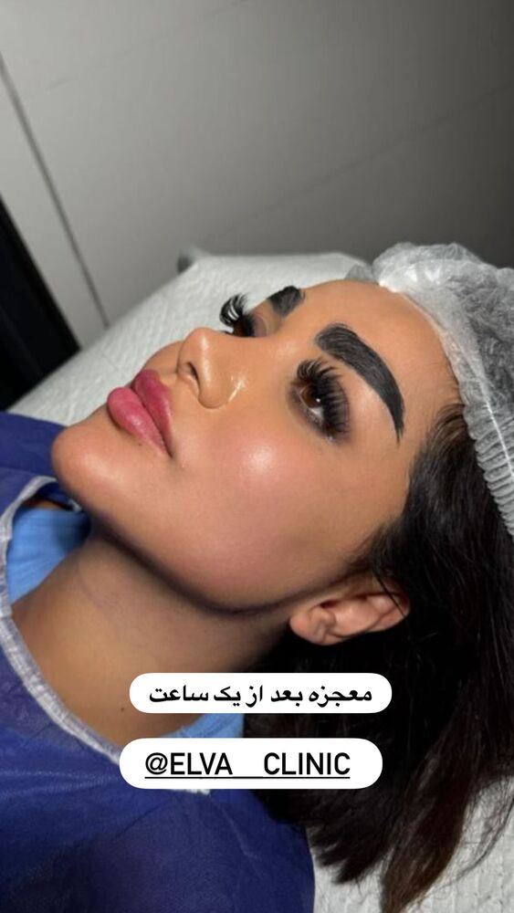  جدید ترین استوری اینستاگرام هانی