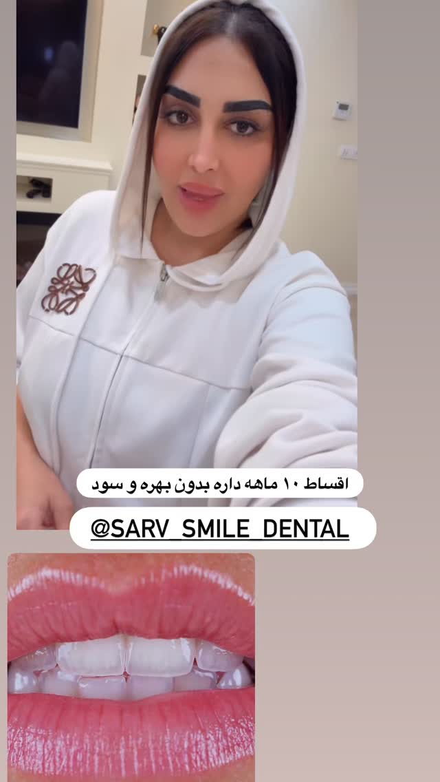  جدید ترین استوری اینستاگرام هانی