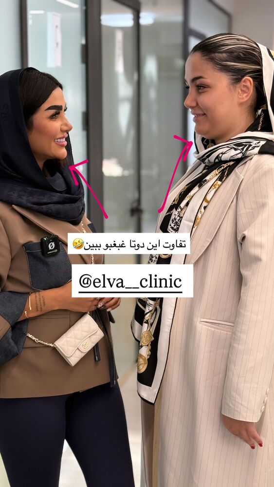  جدید ترین استوری اینستاگرام هانی