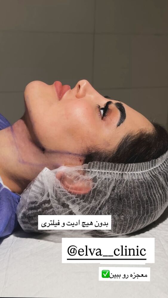  جدید ترین استوری اینستاگرام هانی