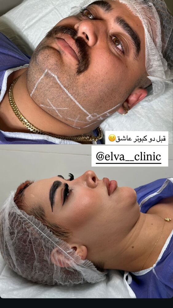  جدید ترین استوری اینستاگرام هانی