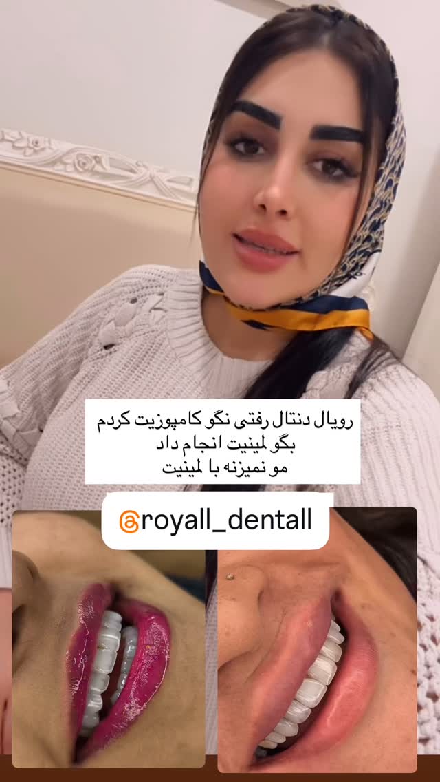  جدید ترین استوری اینستاگرام هانی