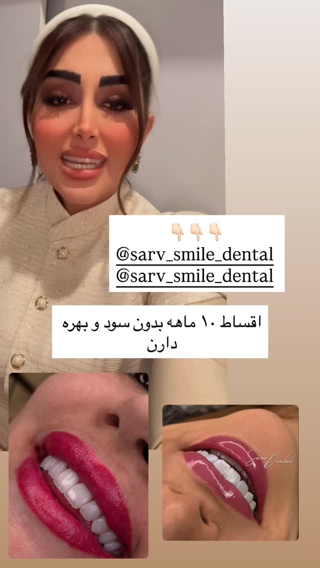  جدید ترین استوری اینستاگرام هانی