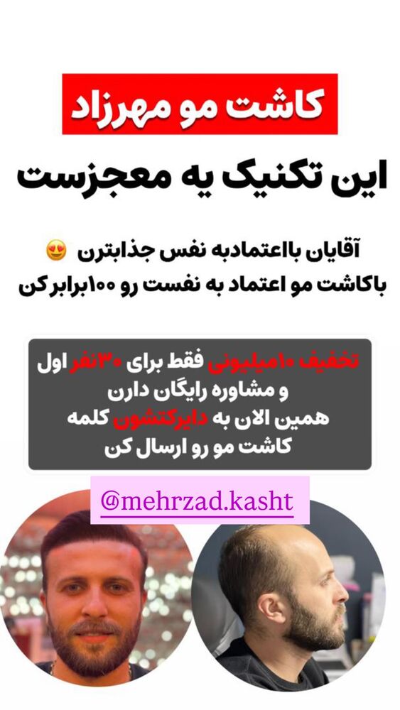  جدید ترین استوری اینستاگرام هانی