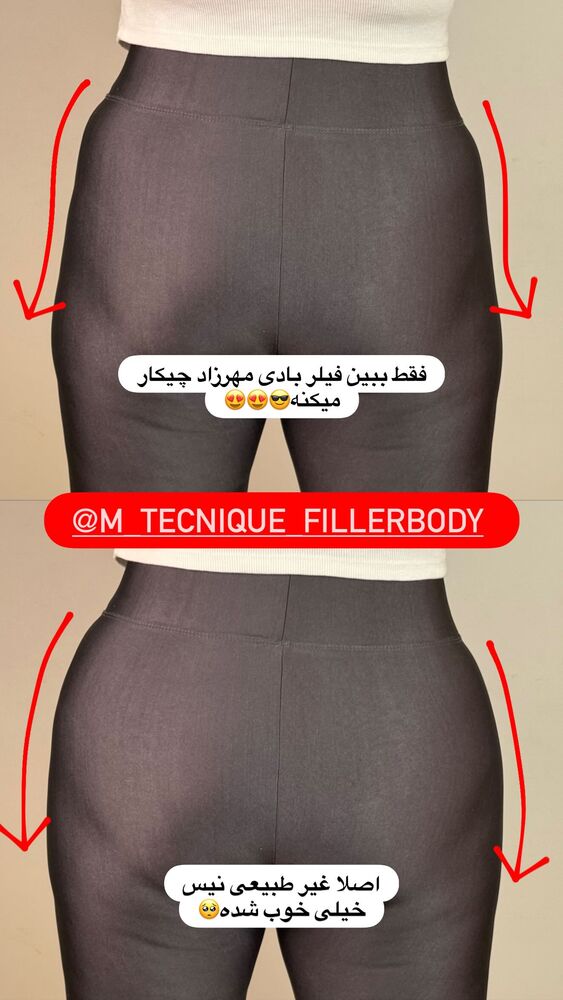  جدید ترین استوری اینستاگرام هانی