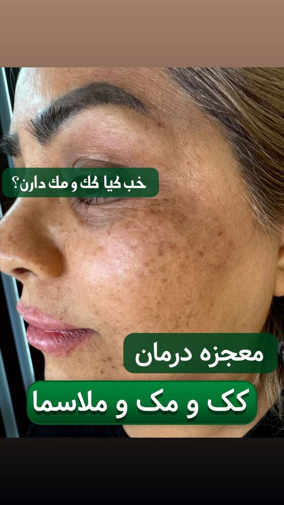  جدید ترین استوری اینستاگرام هانی