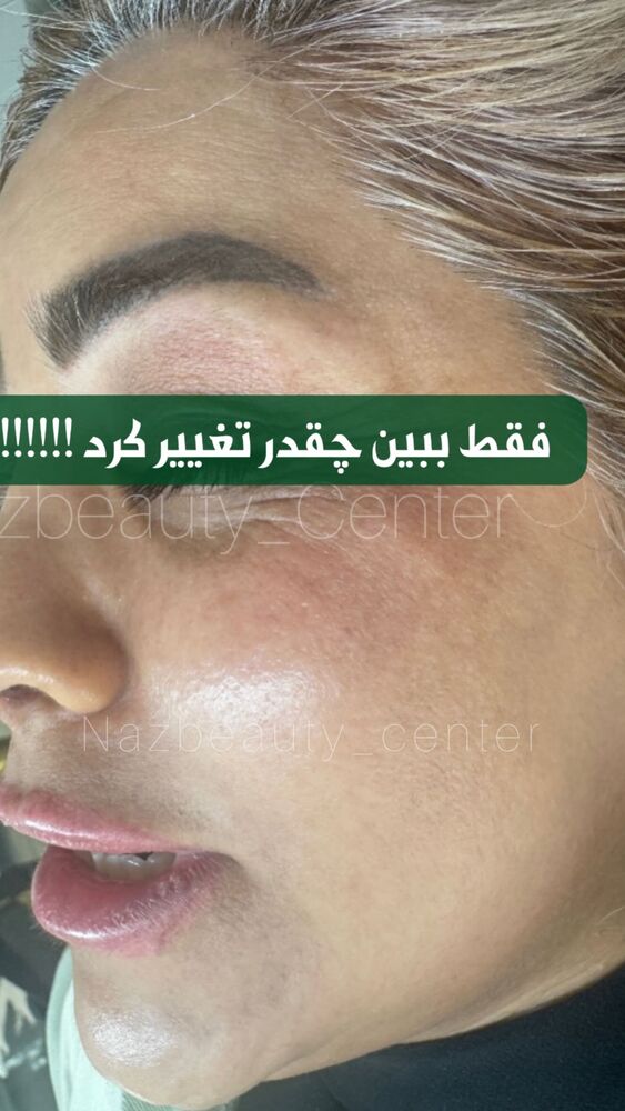  جدید ترین استوری اینستاگرام هانی