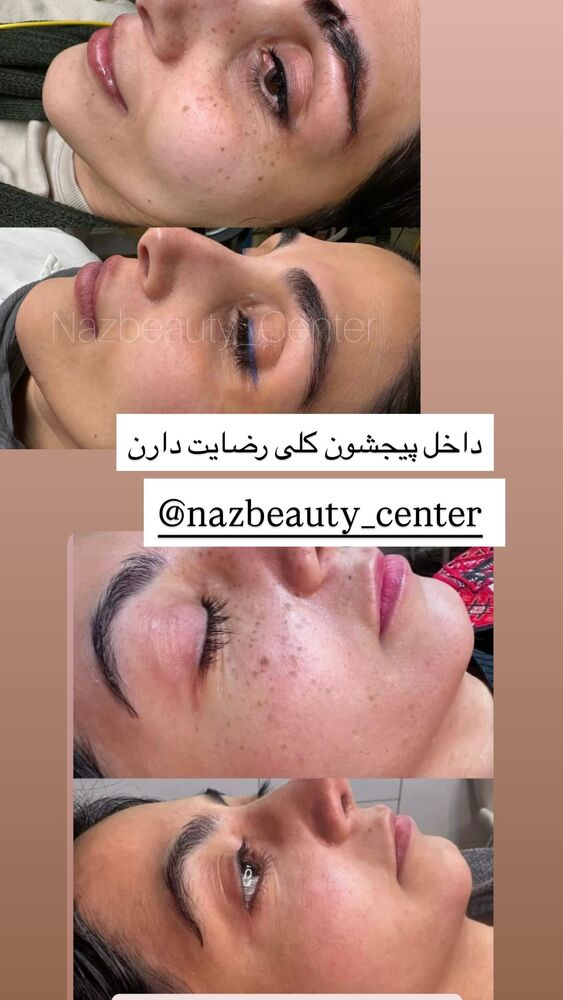  جدید ترین استوری اینستاگرام هانی