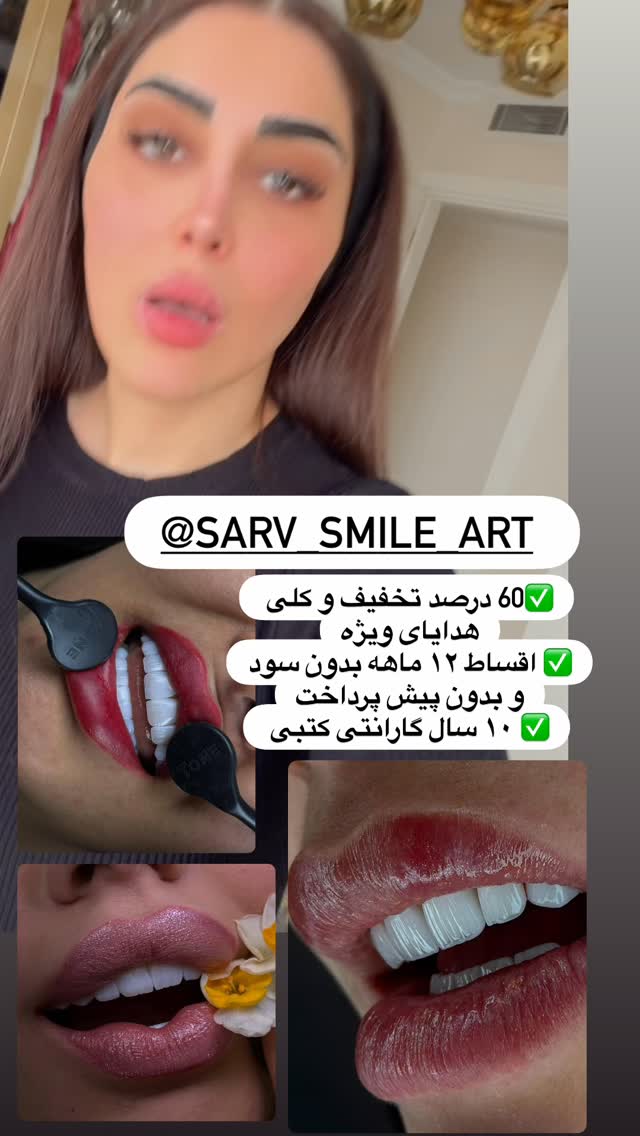  جدید ترین استوری اینستاگرام هانی