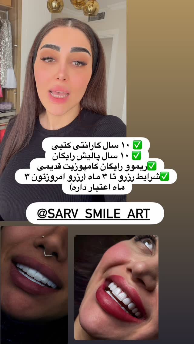  جدید ترین استوری اینستاگرام هانی