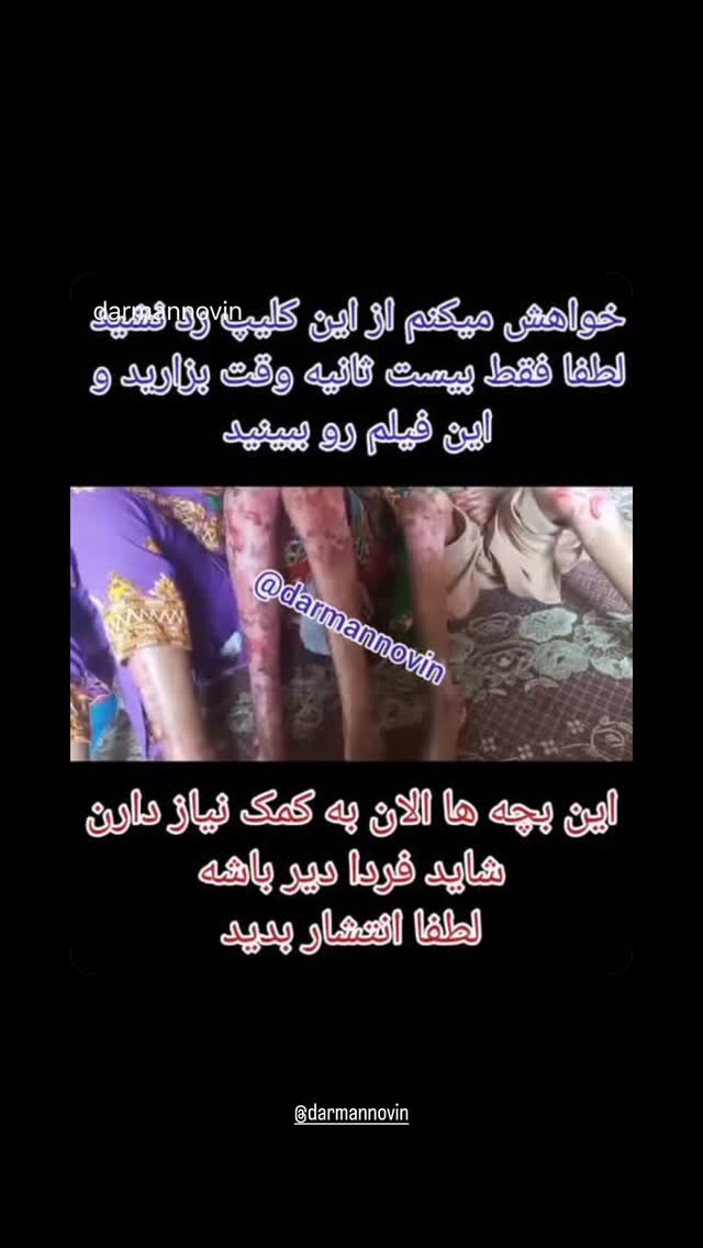  جدید ترین استوری اینستاگرام حسن مصطفوی