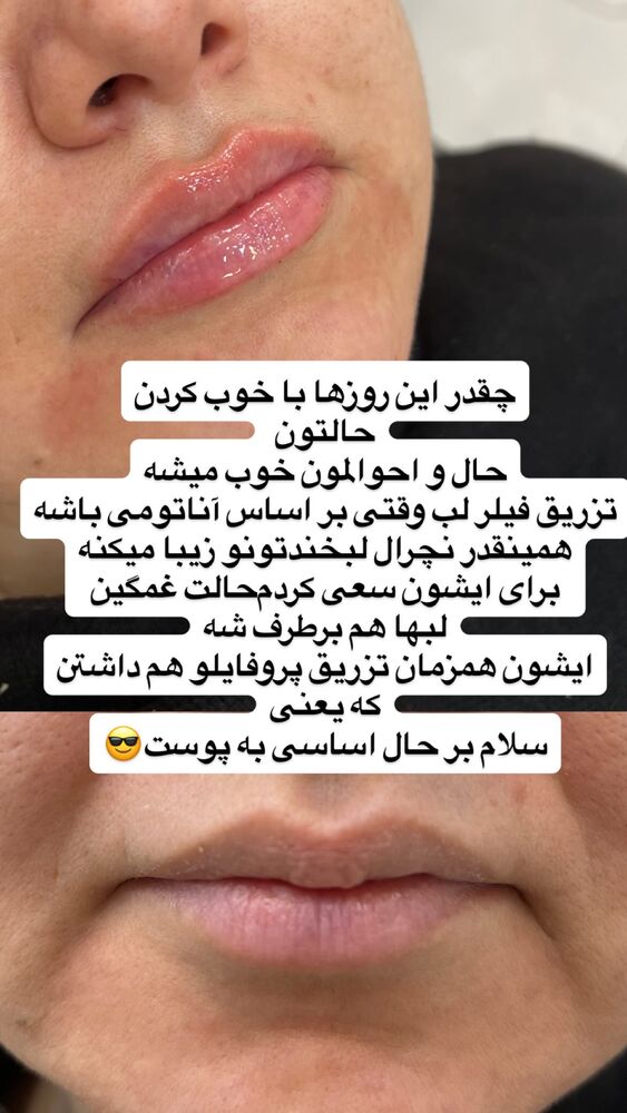  جدید ترین استوری اینستاگرام سمانه سلامیان