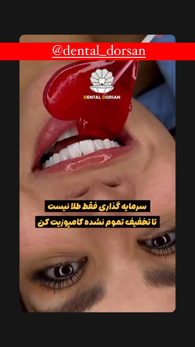  جدید ترین استوری اینستاگرام هومن ایران منش