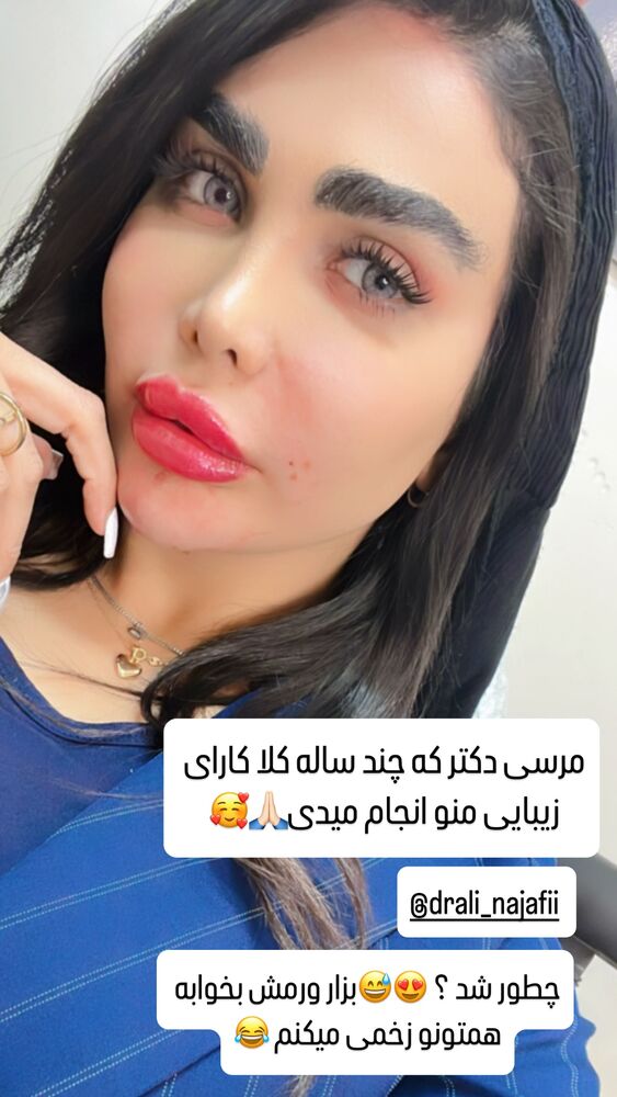  جدید ترین استوری اینستاگرام آیسان بالنده