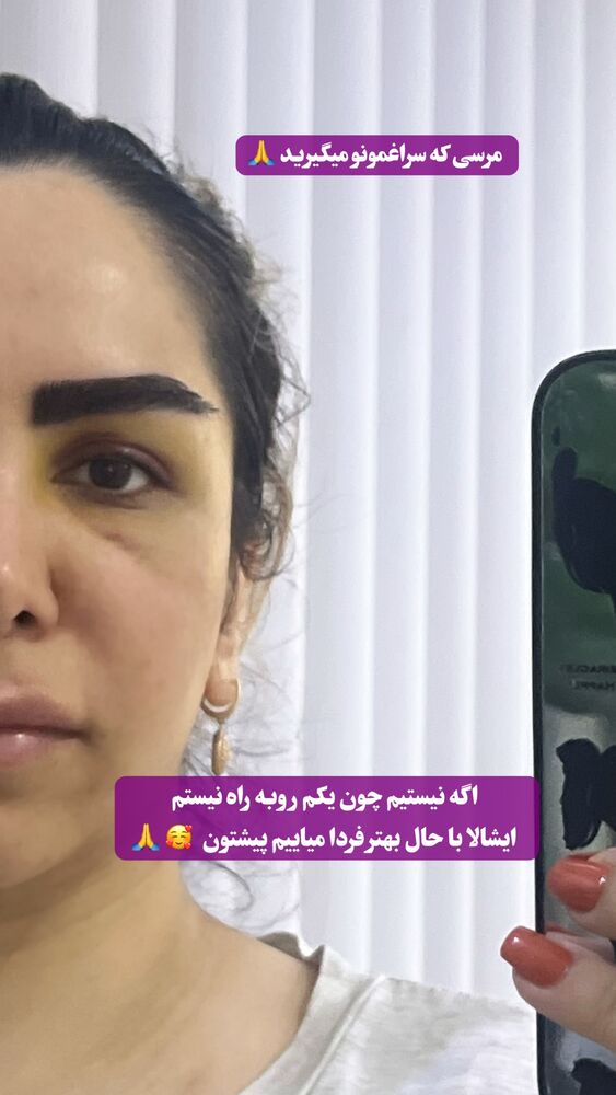  جدید ترین استوری اینستاگرام سلین فمیلی
