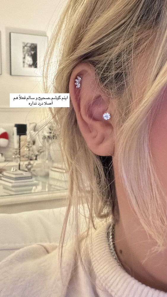  جدید ترین استوری اینستاگرام یاسمین کریمی