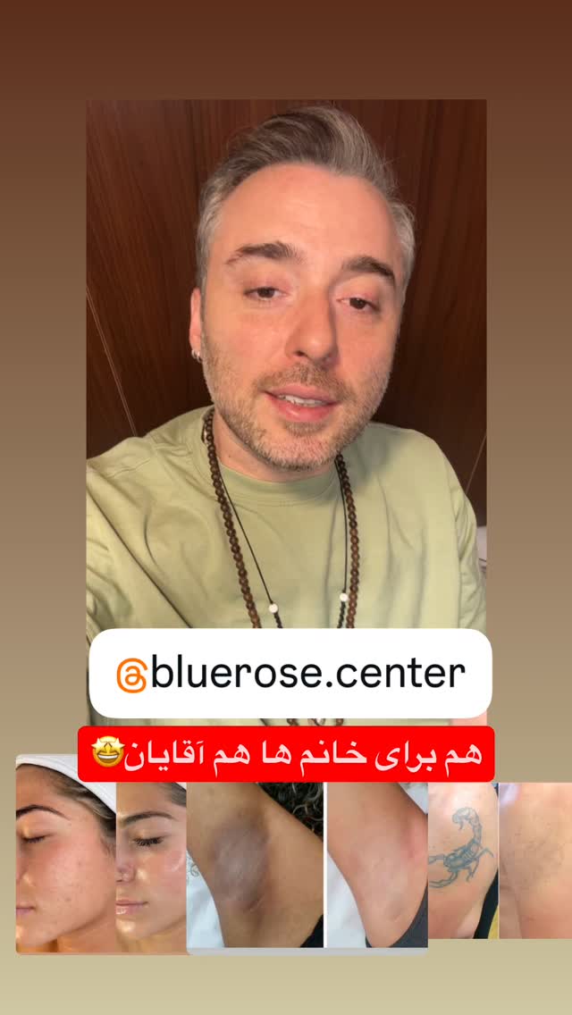  جدید ترین استوری اینستاگرام کاچه ها