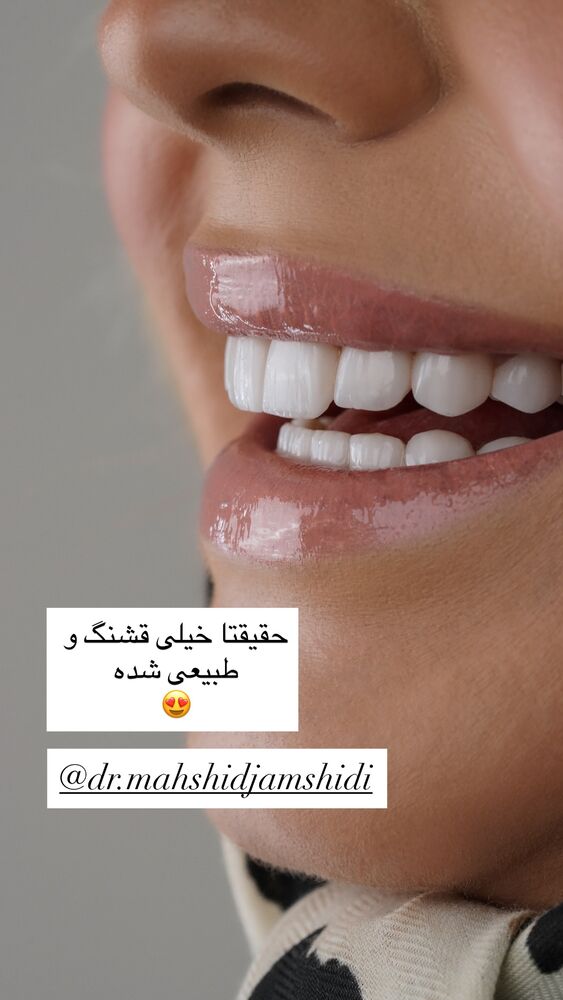  جدید ترین استوری اینستاگرام كامليا رودنشين
