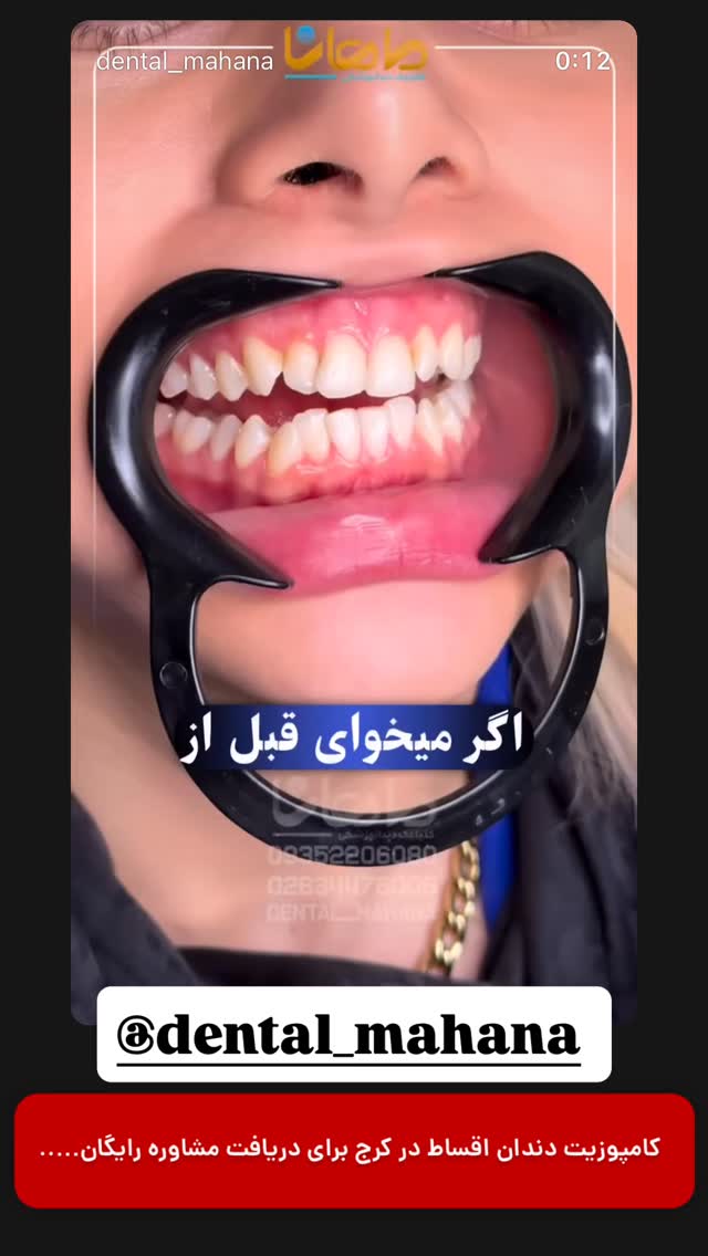 جدید ترین استوری اینستاگرام karaj.yab