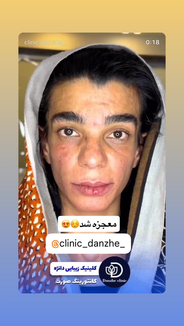  جدید ترین استوری اینستاگرام خلوف