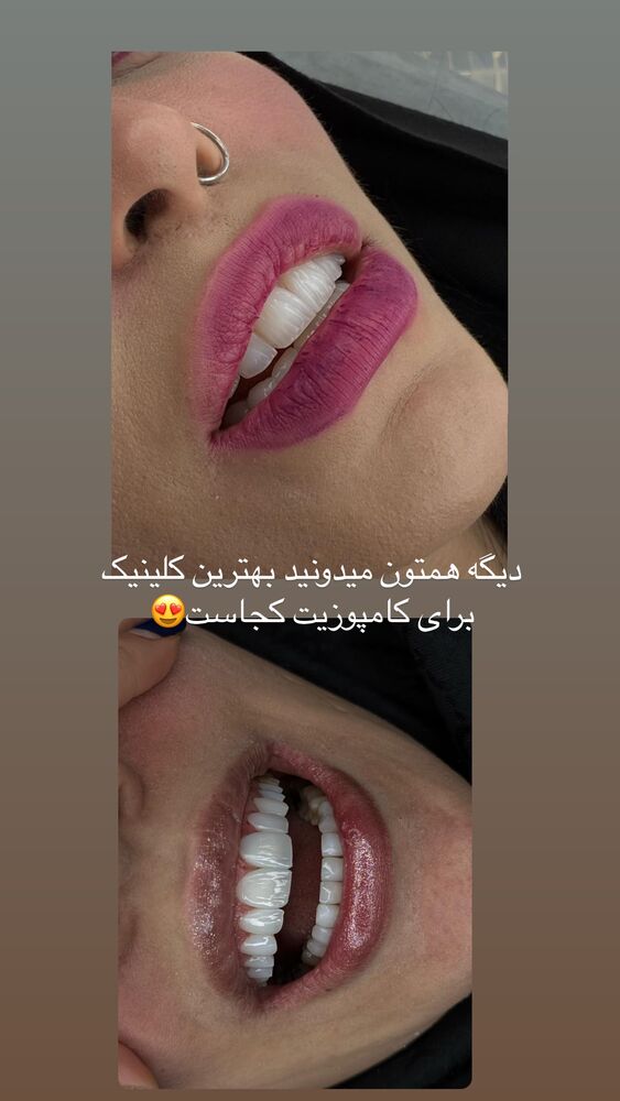  جدید ترین استوری اینستاگرام کوثر مامی