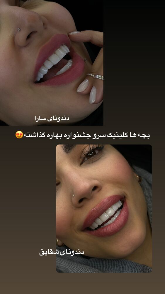  جدید ترین استوری اینستاگرام کوثر مامی