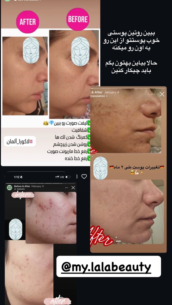  جدید ترین استوری اینستاگرام کوثر مامی