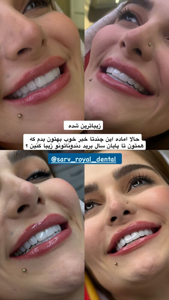  جدید ترین استوری اینستاگرام کوثر مامی