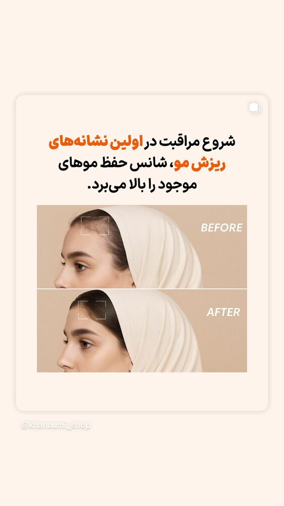  جدید ترین استوری اینستاگرام فروشگاه خانومی