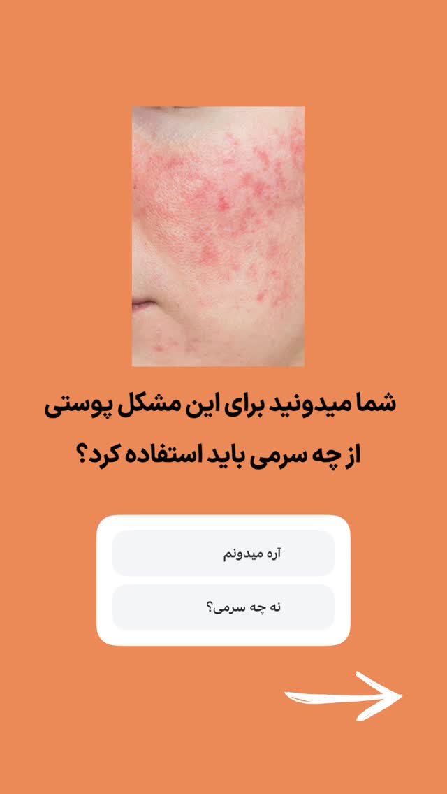  جدید ترین استوری اینستاگرام فروشگاه خانومی