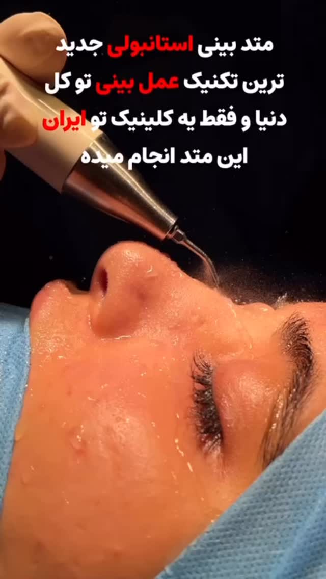  جدید ترین استوری اینستاگرام خود فاطی